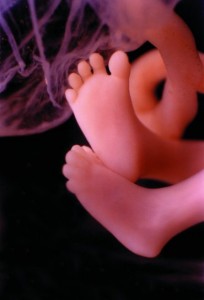 02_Services_b_Fetal Development - 11weeks-legsandfeet